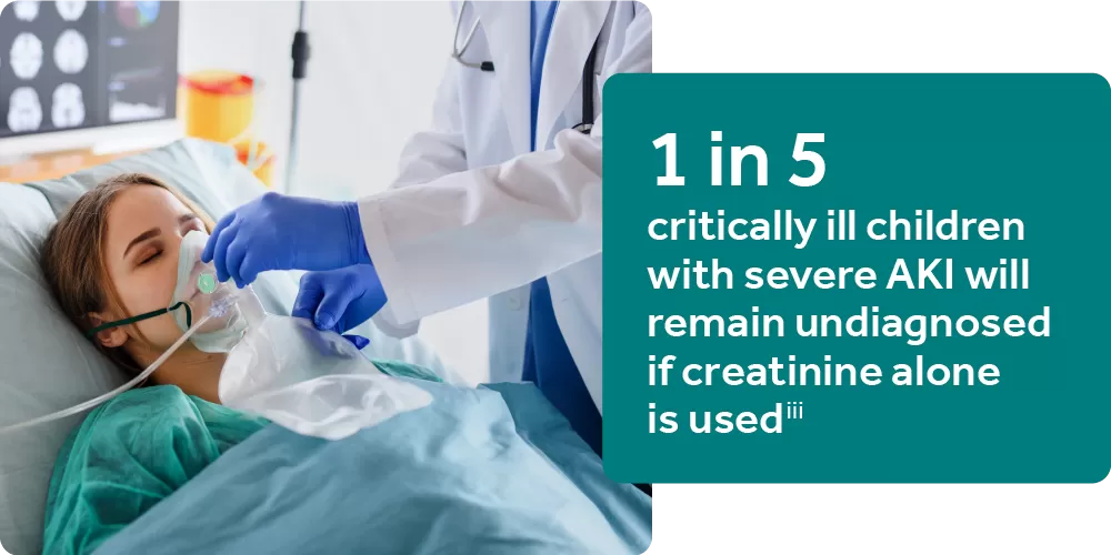 1 in 5 critically ill children with severe AKI will remain undiagnosed if creatinin alone is used.iii